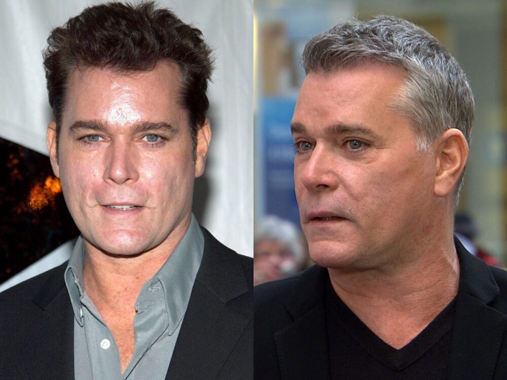 Ray Liotta Plastic Surgery - With Before And After Photos