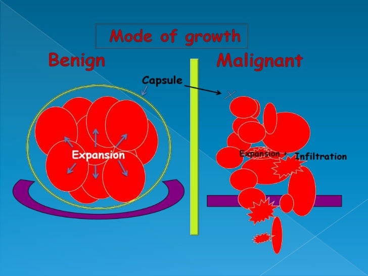 Meaning Of Benign And Malignant Tumors - MEANCRO